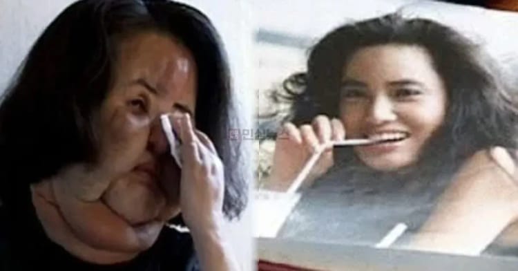 ‘선풍기 아줌마’ 고 한혜경, 50대 사망…꼬꼬무가 전하는 그 이후 (+식용유, 공업용 실리콘, 콩기름, 파라핀 오일)